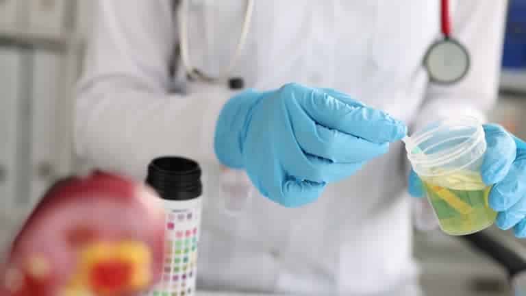 Blood in Urine / Hematuria Treatment West Palm Beach