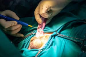 Orchiectomy Cost, Procedure & Recovery Time