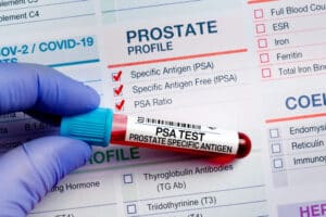 Understanding Your PSA Test Results